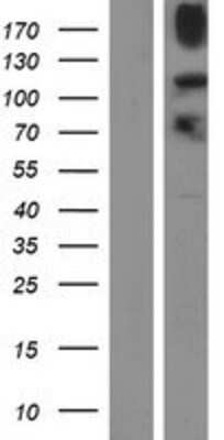 Western Blot: JMJD2B Overexpression Lysate (Adult Normal) [NBP2-10300] Left-Empty vector transfected control cell lysate (HEK293 cell lysate); Right -Over-expression Lysate for JMJD2B.