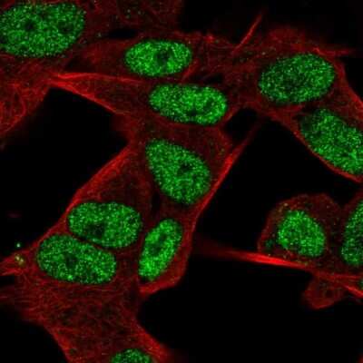 Immunocytochemistry/ Immunofluorescence JMJD2D Antibody - BSA Free