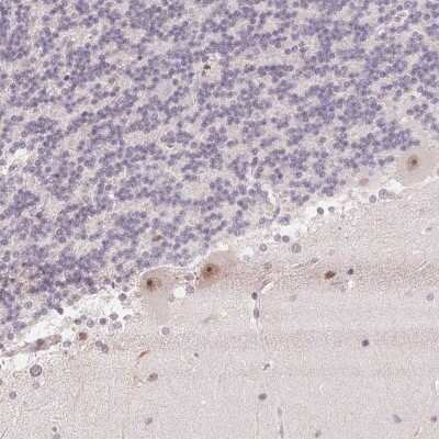 Immunohistochemistry: JMJD2D Antibody [NBP2-49411] - Staining of human cerebellum shows moderate nucleolar positivity in Purkinje cells.