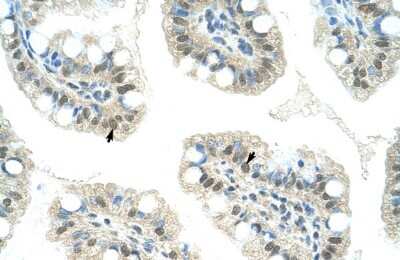 Immunohistochemistry: JMJD2D Antibody [NBP2-87645] - Human Intestine