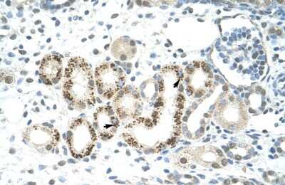 Immunohistochemistry: JMJD2D Antibody [NBP2-87645] - Human kidney