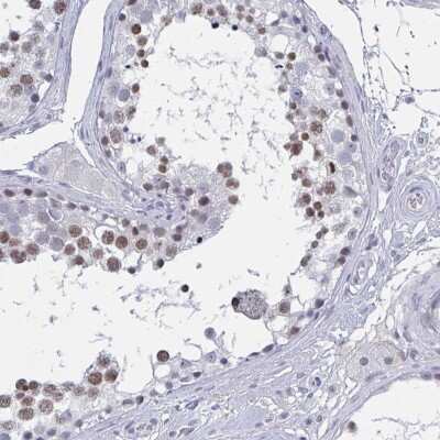 Immunohistochemistry-Paraffin: JMJD2D Antibody [NBP2-47413] - Staining of human testis shows moderate nuclear positivity in subset of cells in seminiferus ducts.