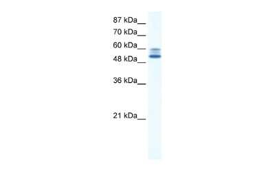 Western Blot: JMJD2D Antibody [NBP2-87644] - WB Suggested Anti-JMJD2D Antibody Titration: 5.0ug/ml. ELISA Titer: 1:62500. Positive Control: HepG2 cell lysate