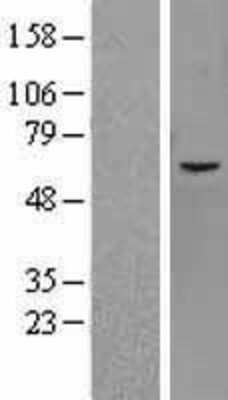 Western Blot: JMJD2D Overexpression Lysate (Adult Normal) [NBL1-12105] Left-Empty vector transfected control cell lysate (HEK293 cell lysate); Right -Over-expression Lysate for JMJD2D.