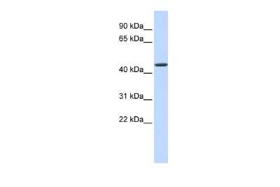 Western Blot: JMJD4 Antibody [NBP2-87647] - WB Suggested Anti-JMJD4 Antibody Titration: 0.2-1 ug/ml. ELISA Titer: 1:12500. Positive Control: Human heart