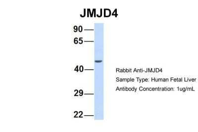 Western Blot: JMJD4 Antibody [NBP2-87647] - Host: Rabbit. Target Name: JMJD4. Sample Type: Human Fetal Liver. Antibody Dilution: 1.0ug/ml