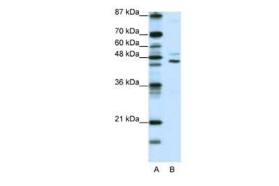 Western Blot: JMJD4 Antibody [NBP2-87649] - WB Suggested Anti-JMJD4 Antibody Titration: 0.2-1 ug/ml. ELISA Titer: 1:62500. Positive Control: Jurkat cell lysate