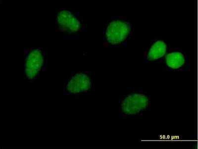 Immunocytochemistry/Immunofluorescence: JMJD5 Antibody [H00079831-B01P] - Analysis of purified antibody to FLJ13798 on HeLa cell. (antibody concentration 10 ug/ml)