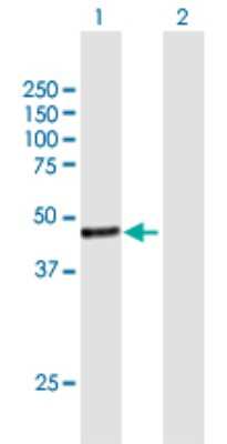 Western Blot: JMJD5 Antibody [H00079831-B01P] - Analysis of JMJD5 expression in transfected 293T cell line by JMJD5 polyclonal antibody.  Lane 1: FLJ13798 transfected lysate(45.76 KDa). Lane 2: Non-transfected lysate.