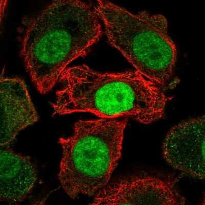 Immunocytochemistry/Immunofluorescence: JMJD6/PSR Antibody [NBP2-57068] - Staining of human cell line PC-3 shows localization to nucleoplasm.