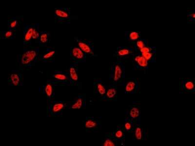 Immunocytochemistry/Immunofluorescence: JMJD6/PSR Antibody [NBP2-98745] - Immunofluorescence staining of JMJD6/PSR in HeLa cells. Cells were fixed with 4% PFA, blocked with 10% serum, and incubated with rabbit anti-human JMJD6/PSR polyclonal antibody (1:5000) at 4C overnight. Then cells were stained with the Alexa Fluor(R)594-conjugated Goat Anti-rabbit IgG secondary antibody (red). Positive staining was localized to nucleus..