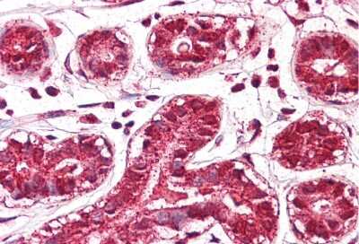 Immunohistochemistry: JMJD6/PSR Antibody [NBP3-10913] - Immunohistochemical analysis of Breast tissue as a positive control using NBP3-10912 (5ug/mL).