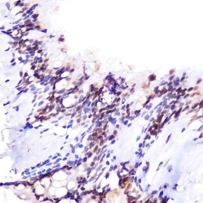 Immunohistochemistry-Paraffin: JMJD6/PSR Antibody [NBP3-03444] - Immunohistochemistry of paraffin-embedded human lung using JMJD6/PSR Rabbit pAb (NBP3-03444) at dilution of 1:100 (40x lens). Perform high pressure antigen retrieval with 10 mM citrate buffer pH 6.0 before commencing with IHC staining protocol.