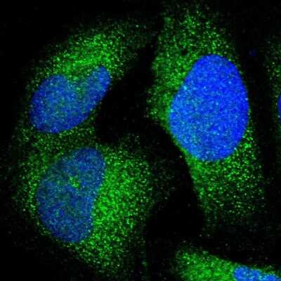 Immunocytochemistry/ Immunofluorescence JMJD7 Antibody - BSA Free