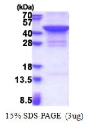 SDS-PAGE Recombinant Human JMJD7 His Protein
