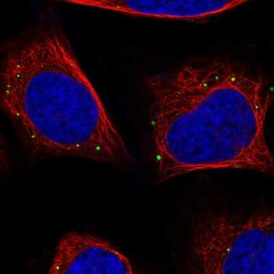 Immunocytochemistry/Immunofluorescence: JNK/JIP3 Antibody [NBP2-38490] - Immunofluorescent staining of human cell line U-2 OS shows localization to vesicles.