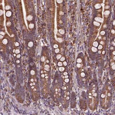 Immunohistochemistry: JNK/JIP3 Antibody [NBP2-49593] - Staining of human duodenum shows cytoplasmic positivity in glandular cells.