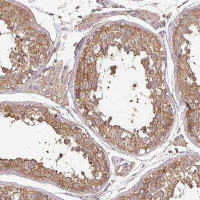 Immunohistochemistry-Paraffin: JNK/JIP3 Antibody [NBP2-38490] - Staining of human testis shows moderate cytoplasmic positivity in cells in seminiferus ducts.