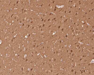 Immunohistochemistry-Paraffin: JNK1 Antibody (SA43-06) [NBP2-67302] - Analysis of paraffin-embedded rat brain tissue with Rabbit anti-JNK1 antibody washed with ddH2O and PBS, and then probed with the primary antibody  at 1/400 dilution for 1 hour at room temperature. The detection was performed using an HRP conjugated compact polymer system. DAB was used as the chromogen. Tissues were counterstained with hematoxylin and mounted with DPX.