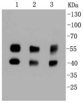 Western Blot: JNK1 Antibody (SA43-06) [NBP2-67302] - Analysis of JNK1+JNK2+JNK3 on different cell lysates using anti-JNK1+JNK2+JNK3 antibody at 1/1,000 dilution. Positive control:  Lane 1: Hela  Lane 2: PC12  Lane 3: K562  Lane 5: HepG2  Lane 6: Human lung