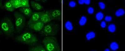 Immunocytochemistry/Immunofluorescence: JNK1 [p Thr183, p Thr221] Antibody (ST500) [NBP2-67514] - Staining Phospho-JNK1/2/3(T183+T183+T221) in HUVEC cells (green). The nuclear counter stain is DAPI (blue). Cells were fixed in paraformaldehyde, permeabilised with 0.25% Triton X100/PBS.