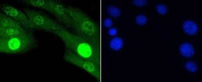 Immunocytochemistry/Immunofluorescence: JNK1 [p Thr183, p Thr221] Antibody (ST500) [NBP2-67514] - Staining Phospho-JNK1/2/3(T183+T183+T221) in NIH/3T3 cells (green). The nuclear counter stain is DAPI (blue). Cells were fixed in paraformaldehyde, permeabilised with 0.25% Triton X100/PBS.