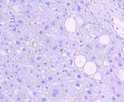 Immunohistochemistry-Paraffin: JNK1 [p Thr183, p Thr221] Antibody (ST500) [NBP2-67514] - Analysis of paraffin-embedded human liver tissue using anti-Phospho-JNK1/2/3(T183+T183+T221) antibody. Counter stained with hematoxylin.