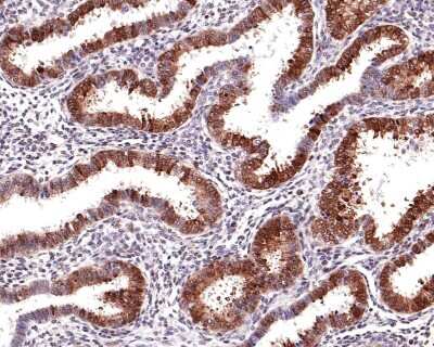 Immunohistochemistry-Paraffin: JNK1 [p Thr183, p Thr221] Antibody (ST500) [NBP2-67514] - Analysis of paraffin-embedded human endometrium tissue with Rabbit anti-JNK1 [p Thr183, p Thr183, p Thr221) antibody washed with ddH2O and PBS, and then probed with the primary antibody  at 1/400 dilution for 1 hour at room temperature. The detection was performed using an HRP conjugated compact polymer system. DAB was used as the chromogen. Tissues were counterstained with hematoxylin and mounted with DPX.