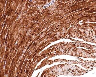 Immunohistochemistry-Paraffin: JNK1 [p Thr183, p Thr221] Antibody (ST500) [NBP2-67514] - Analysis of paraffin-embedded mouse heart tissue with Rabbit anti-Phospho-JNK1 [p Thr183, p Thr183, p Thr221] antibody washed with ddH2O and PBS, and then probed with the primary antibody  at 1/400 dilution for 1 hour at room temperature. The detection was performed using an HRP conjugated compact polymer system. DAB was used as the chromogen. Tissues were counterstained with hematoxylin and mounted with DPX.