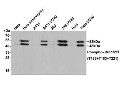 Western Blot: JNK1 [p Thr183, p Thr221] Antibody (ST500) [NBP2-67514] - Analysis of JNK1/2/3 [p Thr183, p Thr183, p Thr221] on different lysates with Rabbit anti- JNK1/2/3 [p Thr183, p Thr183, p Thr221] antibody (untreated Lane 2: Hela cell lysate, treated with Anisomycin Lane 3: A431 cell lysate, untreated Lane 4: A431 cell lysate, treated with UV40 Lane 5: 293 cell lysate, untreated Lane 6: 293 cell lysate, treated with UV40 Lane 7: Hela cell lysate, untreated Lane 8: Hela cell lysate, treated with UV40  Lysates/proteins at 10 ug/Lane. Predicted band size: 48/53 kDa Observed band size: 48/53 kDa Exposure time: 2 minutes; 12% SDS-PAGE gel. Proteins were transferred to a PVDF membrane and blocked with 5% NFDM/TBST for 1 hour at room temperature. The primary antibody at 1/1,000 dilution was used in 5% NFDM/TBST at room temperature for 2 hours. Goat Anti-Rabbit IgG - HRP Secondary Antibody at 1:300,000 dilution was used for 1 hour at room temperature.