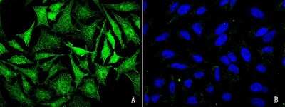 Immunocytochemistry/Immunofluorescence: JNK2 Antibody [NBP2-98811] - Immunofluorescence staining of JNK2 in HeLa cells. Cells were fixed with 4% PFA, blocked with 10% serum. Then incubated with rabbit anti-human JNK2 polyclonal antibody (1:1000)(Figure A), incubated with rabbit anti-human JNK2 polyclonal antibody and antigen (Figure B) at 4C overnight. Then cells were stained with the Alexa Fluor(R)488-conjugated Goat Anti-rabbit IgG Secondary antibody (green) and counterstained with DAPI (blue). Positive staining was localized to cytoplasm and nucleus.