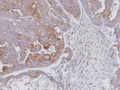 Immunohistochemistry-Paraffin: JNK2 Antibody [NBP1-30905] - Paraffin-embedded N87 xenograft, using antibody at 1:100 dilution.