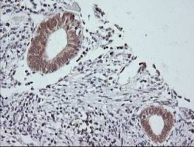 Immunohistochemistry: JNK2 Antibody (OTI1A1) - Azide and BSA Free [NBP2-71259] - Analysis of Human endometrium tissue. (Heat-induced epitope retrieval by 10mM citric buffer, pH6.0, 120C for 3min)