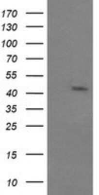 Western Blot: JNK2 Antibody (OTI1A1) - Azide and BSA Free [NBP2-71259] - Analysis of HEK293T cells were transfected with the pCMV6-ENTRY control (Left lane) or pCMV6-ENTRY JNK2.