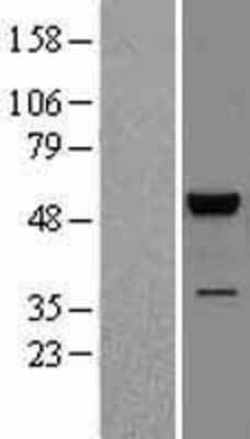 Western Blot: JNK2 Overexpression Lysate (Adult Normal) [NBL1-12885] Left-Empty vector transfected control cell lysate (HEK293 cell lysate); Right -Over-expression Lysate for JNK2.