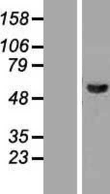 Western Blot: JNK2 Overexpression Lysate (Adult Normal) [NBP2-05607] Left-Empty vector transfected control cell lysate (HEK293 cell lysate); Right -Over-expression Lysate for JNK2.