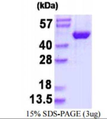 SDS-Page: Recombinant Human JNK2 Protein [NBP1-98883]