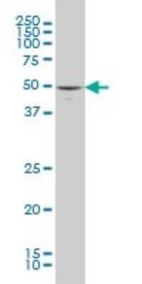 Western Blot: JNK3 Antibody (3A3-1A8) [H00005602-M03] - Analysis of MAPK10 expression in A-431 (Cat # L015V1).