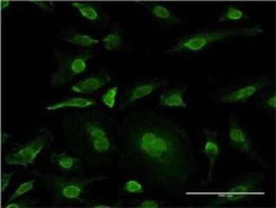 Immunocytochemistry/Immunofluorescence: JNK3 Antibody (4E12-1F7) [H00005602-M01] - Analysis of monoclonal antibody to MAPK10 on HeLa cell . Antibody concentration 10 ug/ml.