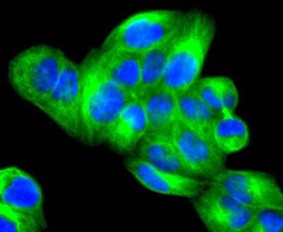 Immunocytochemistry/Immunofluorescence: JNK3 Antibody (SD082-09) [NBP2-67800] - Staining JNK3 in Hela cells (green). The nuclear counter stain is DAPI (blue). Cells were fixed in paraformaldehyde, permeabilised with 0.25% Triton X100/PBS.