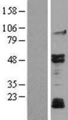 Western Blot: JNK3 Overexpression Lysate (Adult Normal) [NBL1-12867] Left-Empty vector transfected control cell lysate (HEK293 cell lysate); Right -Over-expression Lysate for JNK3.