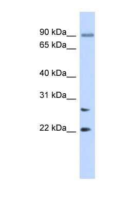 Western Blot JOSD2 Antibody - BSA Free