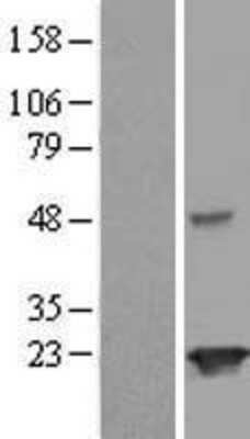 Western Blot: JOSD2 Overexpression Lysate (Adult Normal) [NBL1-12109] Left-Empty vector transfected control cell lysate (HEK293 cell lysate); Right -Over-expression Lysate for JOSD2.