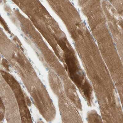 Immunohistochemistry-Paraffin: JPH1 Antibody [NBP1-83076] - Staining of human skeletal muscle shows strong cytoplasmic positivity in myocytes.