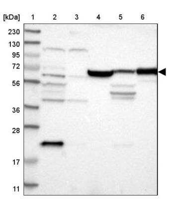 Western Blot: JPH1 Antibody [NBP1-83076] - Lane 1: Marker  [kDa] 230, 130, 95, 72, 56, 36, 28, 17, 11.  Lane 2: Human cell line RT-4.  Lane 3: Human cell line U-251MG sp.  Lane 4: Human plasma (IgG/HSA depleted).  Lane 5: Human liver tissue.  Lane 6: Human tonsil tissue