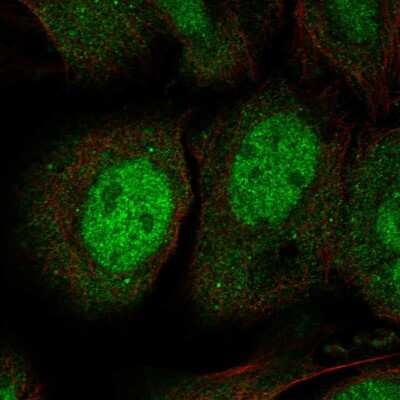 Immunocytochemistry/Immunofluorescence: JPH3 Antibody [NBP2-56422] - Staining of human cell line SiHa shows localization to nucleoplasm & cytosol.