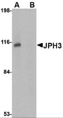 Western Blot: JPH3 Antibody [NBP2-81726] - Analysis of JPH3 in Daudi cell lysate with JPH3 antibody at 1 ug/ml in (A) the absence and (B) the presence of blocking peptide.