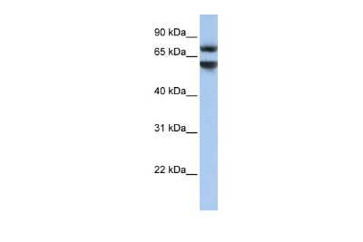 Western Blot: JPH3 Antibody [NBP2-83095] - WB Suggested Anti-JPH3 Antibody Titration: 0.2-1 ug/ml. Positive Control: HepG2 cell lysate