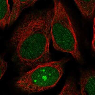 Immunocytochemistry/Immunofluorescence: JRK Antibody [NBP2-55780] - Staining of human cell line U-2 OS shows localization to nucleus & nucleoli.