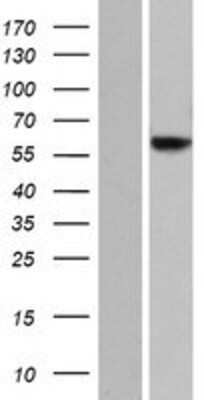 Western Blot: JRK Overexpression Lysate (Adult Normal) [NBP2-08462] Left-Empty vector transfected control cell lysate (HEK293 cell lysate); Right -Over-expression Lysate for JRK.